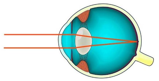 L'oeil normal