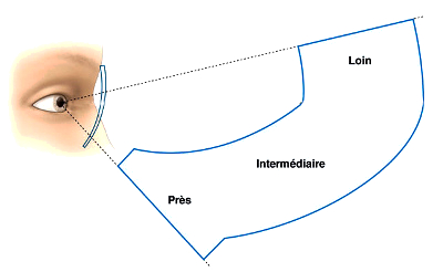 Le progressif et la continuité